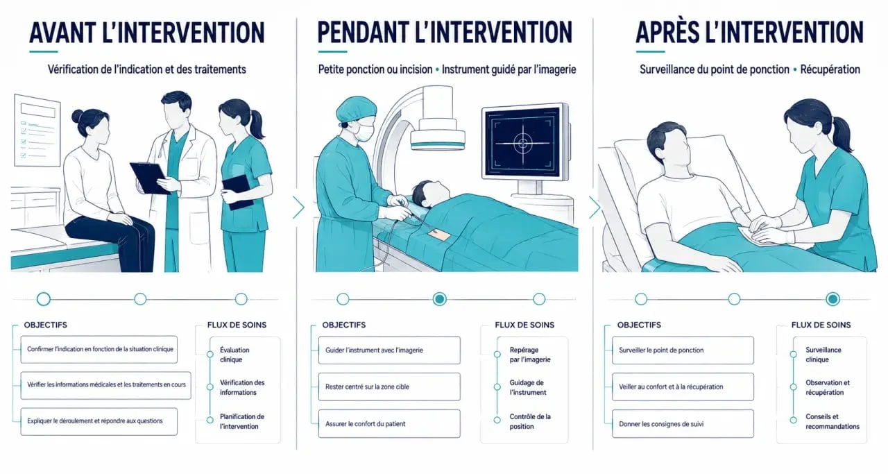 Schéma du parcours d’un acte de radiologie interventionnelle avant, pendant et après l’intervention